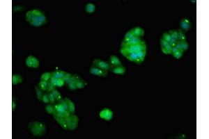 Immunofluorescent analysis of HepG2 cells using ABIN7163743 at dilution of 1:100 and Alexa Fluor 488-congugated AffiniPure Goat Anti-Rabbit IgG(H+L) (PARP14 antibody  (AA 1600-1712))