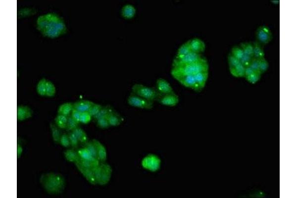 PARP14 antibody  (AA 1600-1712)