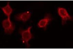 ABIN6276167 staining COLO205 by IF/ICC. (OR5D3P antibody)
