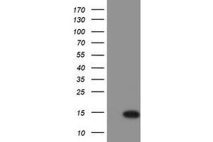 Western Blotting (WB) image for anti-Chromosome 17 Open Reading Frame 37 (C17orf37) antibody (ABIN1501778) (C17orf37 antibody)