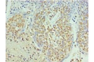 Immunohistochemistry of paraffin-embedded human tonsil tissue using ABIN7168869 at dilution of 1:100 (Septin 6 antibody  (AA 350-434))