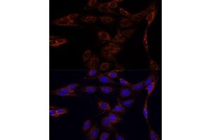 Immunofluorescence analysis of C6 cells using PFDN4 antibody (ABIN7269508) at dilution of 1:100. (PFDN4 antibody  (AA 1-134))