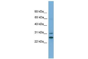 WB Suggested Anti-DHRS2  Antibody Titration: 0. (DHRS2 antibody  (N-Term))