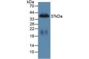 Detection of Recombinant PP, Mouse using Polyclonal Antibody to Pancreatic Polypeptide (PP) (PPY antibody  (AA 31-97))