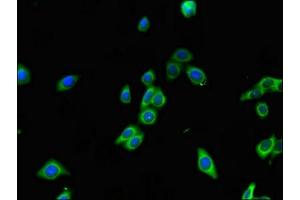 Immunofluorescent analysis of HepG2 cells using ABIN7167377 at dilution of 1:100 and Alexa Fluor 488-congugated AffiniPure Goat Anti-Rabbit IgG(H+L) (RAB7A antibody  (AA 110-177))