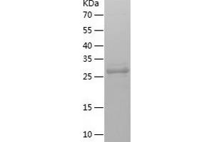 Western Blotting (WB) image for Biphenyl Hydrolase-Like (Serine Hydrolase) (BPHL) (AA 38-291) protein (His tag) (ABIN7122003) (BPHL Protein (AA 38-291) (His tag))