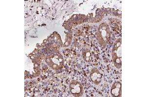 Immunohistochemical staining of human rectum with METTL22 polyclonal antibody  shows moderate cytoplasmic positivity in glandular cells. (METTL22 antibody)