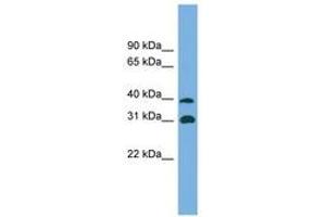 Image no. 1 for anti-Crystallin, mu (CRYM) (AA 179-228) antibody (ABIN6743608) (CRYM antibody  (AA 179-228))