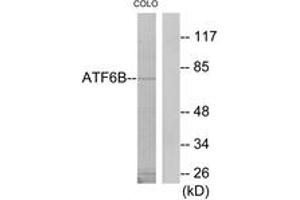 Western blot analysis of extracts from COLO205 cells, using ATF6B Antibody. (ATF6B antibody  (AA 401-450))
