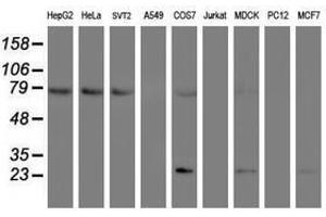 Image no. 1 for anti-Folate Hydrolase (Prostate-Specific Membrane Antigen) 1 (FOLH1) antibody (ABIN1500455) (PSMA antibody)