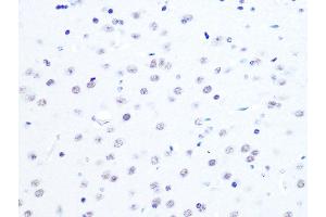 Immunohistochemistry of paraffin-embedded mouse brain using L Rabbit mAb (ABIN7270266) at dilution of 1:100 (40x lens). (ASH2L antibody)