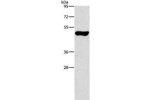 Western Blot analysis of Mouse pancreas tissue using ILK Polyclonal Antibody at dilution of 1:550 (ILK antibody)