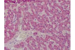 Human Liver: Formalin-Fixed, Paraffin-Embedded (FFPE) (GSTM1 antibody)
