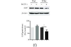 The effects of BoHV-1 infection on the gene expression of antioxidant enzymes. (Catalase antibody  (AA 1-225))