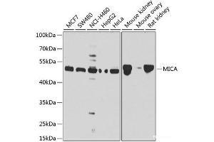 Western blot analysis of extracts of various cell lines using MICA Polyclonal Antibody at dilution of 1:1000.