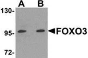 Western blot analysis of FOXO3 in A-20 cell lysate with FOXO3 antibody at (A) 0. (FOXO3 antibody  (N-Term))