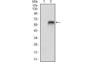 Western blot analysis using VTN mAb against HEK293 (1) and VTN (AA: 20-199)-hIgGFc transfected HEK293 (2) cell lysate. (Vitronectin antibody  (AA 20-199))