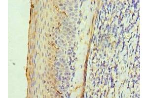 Immunohistochemistry of paraffin-embedded human tonsil tissue using ABIN7142595 at dilution of 1:100 (ALAS2 antibody  (AA 50-320))