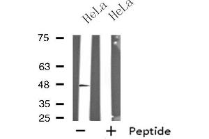 Western blot analysis of extracts from HeLa cells, using GPR19 antibody. (GPR19 antibody  (C-Term))