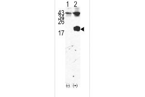 Western blot analysis of FKBP12 (arrow) using rabbit polyclonal FKBP12 Antibody (Center) (ABIN392172 and ABIN2841886).