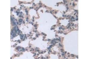 Figure. (Connexin 31 antibody  (AA 210-270))
