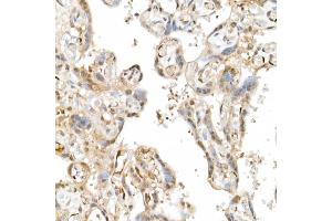 Immunohistochemistry (IHC) image for anti-WW Domain Containing Transcription Regulator 1 (WWTR1) (AA 1-230) antibody (ABIN6150278)