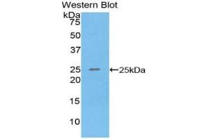 Western blot analysis of the recombinant protein. (SPRY3 antibody  (AA 91-288))