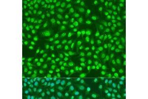 Immunofluorescence analysis of U2OS cells using PSEN2 Polyclonal Antibody at dilution of 1:100. (Presenilin 2 antibody)