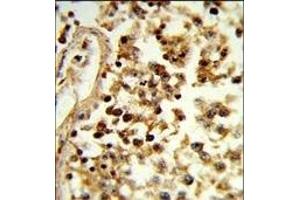 Formalin-fixed and paraffin-embedded human testis tissue reacted with IL31 Antibody (N-term), which was peroxidase-conjugated to the secondary antibody, followed by DAB staining. (IL-31 antibody  (N-Term))