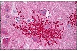 Human Brain, Astrocytes Microglia: Formalin-Fixed, Paraffin-Embedded (FFPE) (CXCR4 antibody  (C-Term))