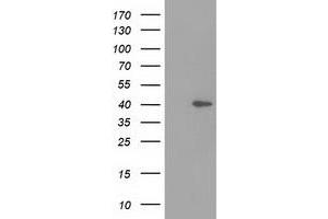 HEK293T cells were transfected with the pCMV6-ENTRY control (Left lane) or pCMV6-ENTRY DNAJB1 (Right lane) cDNA for 48 hrs and lysed. (DNAJB1 antibody)