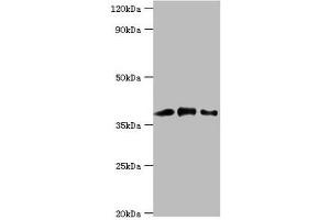 Western blot All lanes: Macrophage-capping protein antibody at 1 μg/mL Lane 1: Hela whole cell lysate Lane 2: NIH/3T3 whole cell lysate Lane 3: Rat lung tissue Secondary Goat polyclonal to rabbit IgG at 1/10000 dilution Predicted band size: 39, 37 kDa Observed band size: 39 kDa (CAPG antibody  (AA 1-348))