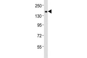 Western blot testing of Tet1 antibody at 1:2000 dilution + F9 lysate; Predicted band size : 219 kDa. (TET1 antibody  (C-Term))