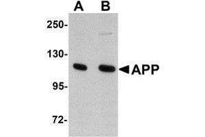 Western blot analysis of APP in rat brain tissue lysate with AP30073PU-N APP antibody at (A) 1 and (B) 2 μg/ml. (APP antibody  (N-Term))