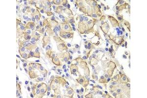 Immunohistochemistry of paraffin-embedded Human stomach using Lyn Polyclonal Antibody at dilution of 1:100 (40x lens). (LYN antibody)