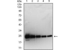 Western blot analysis using SARS-Cov2-NP2 mAb against human SARS-Cov2-N (AA: 120-300) recombinant protein. (SARS-Cov2-NP2 (AA 120-300) antibody)