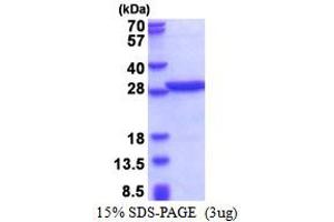 PABPN1 Protein (AA 119-306) (His tag)