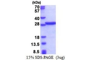 SDS-PAGE (SDS) image for Poly A Binding Protein Nuclear 1 (PABPN1) (AA 119-306) protein (His tag) (ABIN5853467) (PABPN1 Protein (AA 119-306) (His tag))