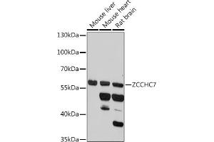 Western blot analysis of extracts of various cell lines, using ZCCHC7 antibody (ABIN7271547) at 1:1000 dilution. (ZCCHC7 antibody)
