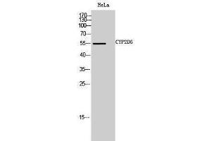 Western Blotting (WB) image for anti-Cytochrome P450, Family 2, Subfamily D, Polypeptide 6 (CYP2D6) (Internal Region) antibody (ABIN3184186) (CYP2D6 antibody  (Internal Region))
