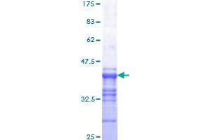 MYB Protein (AA 541-640) (GST tag)