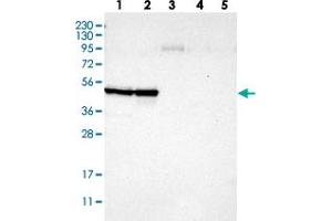 Western blot analysis of Lane 1: RT-4, Lane 2: U-251 MG, Lane 3: Human Plasma, Lane 4: Liver, Lane 5: Tonsil with CCNB2 polyclonal antibody  at 1:250-1:500 dilution. (Cyclin B2 antibody)