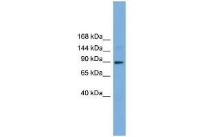 WB Suggested Anti-TTC27 Antibody Titration: 0. (TTC27 antibody  (N-Term))