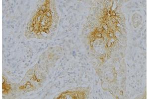 ABIN6276830 at 1/100 staining Human uterus tissue by IHC-P. (Complement Factor B antibody  (Internal Region))