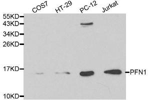 Western blot analysis of extracts of various cell lines, using PFN1 antibody. (PFN1 antibody  (AA 1-140))