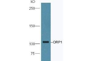 OSBPL1A antibody  (AA 851-950)