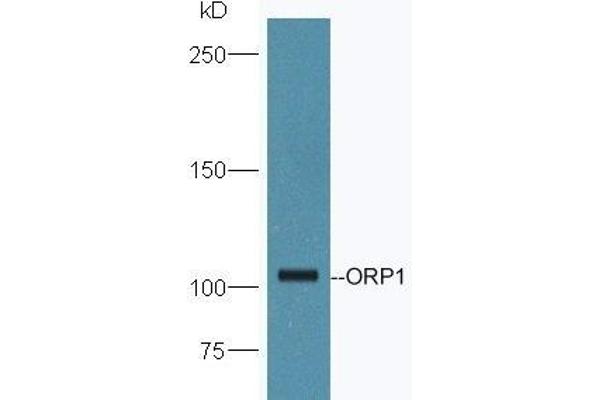 OSBPL1A antibody  (AA 851-950)