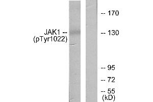 Western blot analysis of extracts from A549 cells, using JAK1 (Phospho-Tyr1022) antibody. (JAK1 antibody  (pTyr1022))