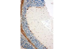 Immunohistochemistry (IHC) image for anti-Signal Sequence Receptor gamma (SSRg) (AA 8-23), (N-Term) antibody (ABIN3044181)