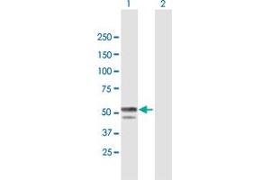 Western Blot analysis of BLMH expression in transfected 293T cell line by BLMH MaxPab polyclonal antibody. (BLMH antibody  (AA 1-455))